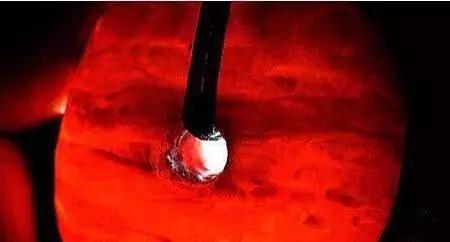 蜜蜡鸡油黄的好还是骨瓷白的好,琥珀蜜蜡鸡油黄好还是带红皮的好