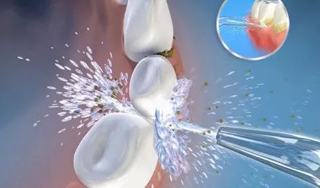 牙齿很黄推荐哪种电动牙刷,牙白口气清新