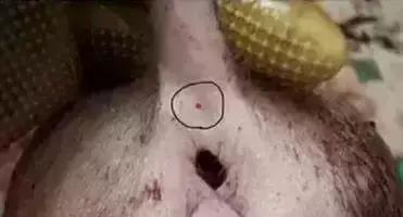 穴位治病大全20招,穴位疗法十大手法