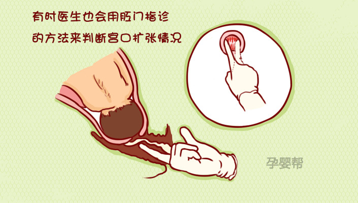 开宫口顺产疼痛难忍,开宫口过程中盆骨痛