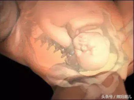 顺产是撕心裂肺的疼？高清图揭示分娩的真相！