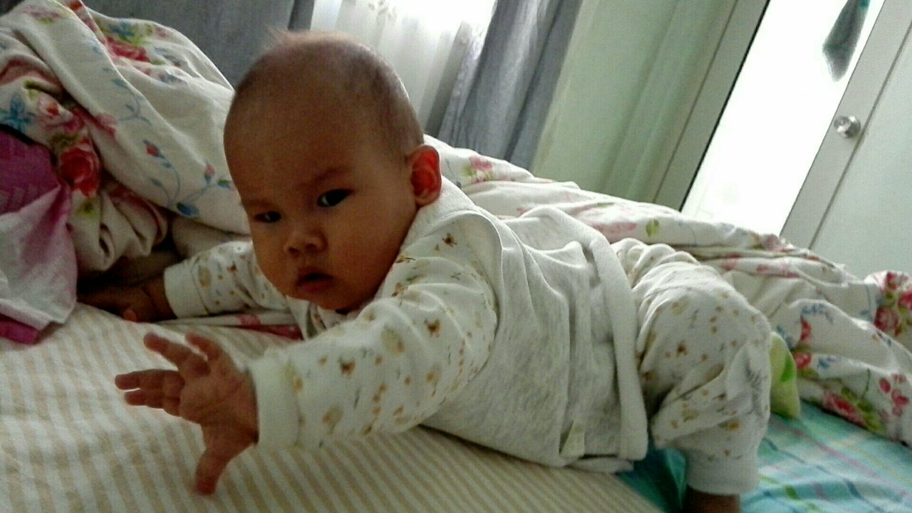 新生儿怎么护理不起湿疹,宝宝脐带没掉怎么注意