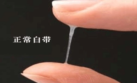 女生白带多有哪些食疗,女生白带增多用什么药效果好