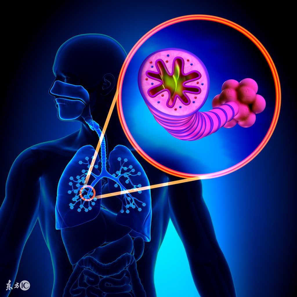 慢性阻塞性肺病是不是肺气肿,慢性肺气肿和慢性阻塞性肺疾病