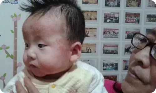 孩子湿热体质怎么调理,湿热痰湿体质如何调理