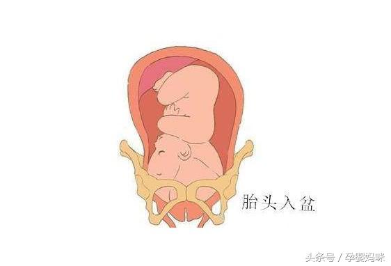 怀孕后期发现宝宝有问题怎么办,孕晚期胎儿入盆后胎动有什么症状