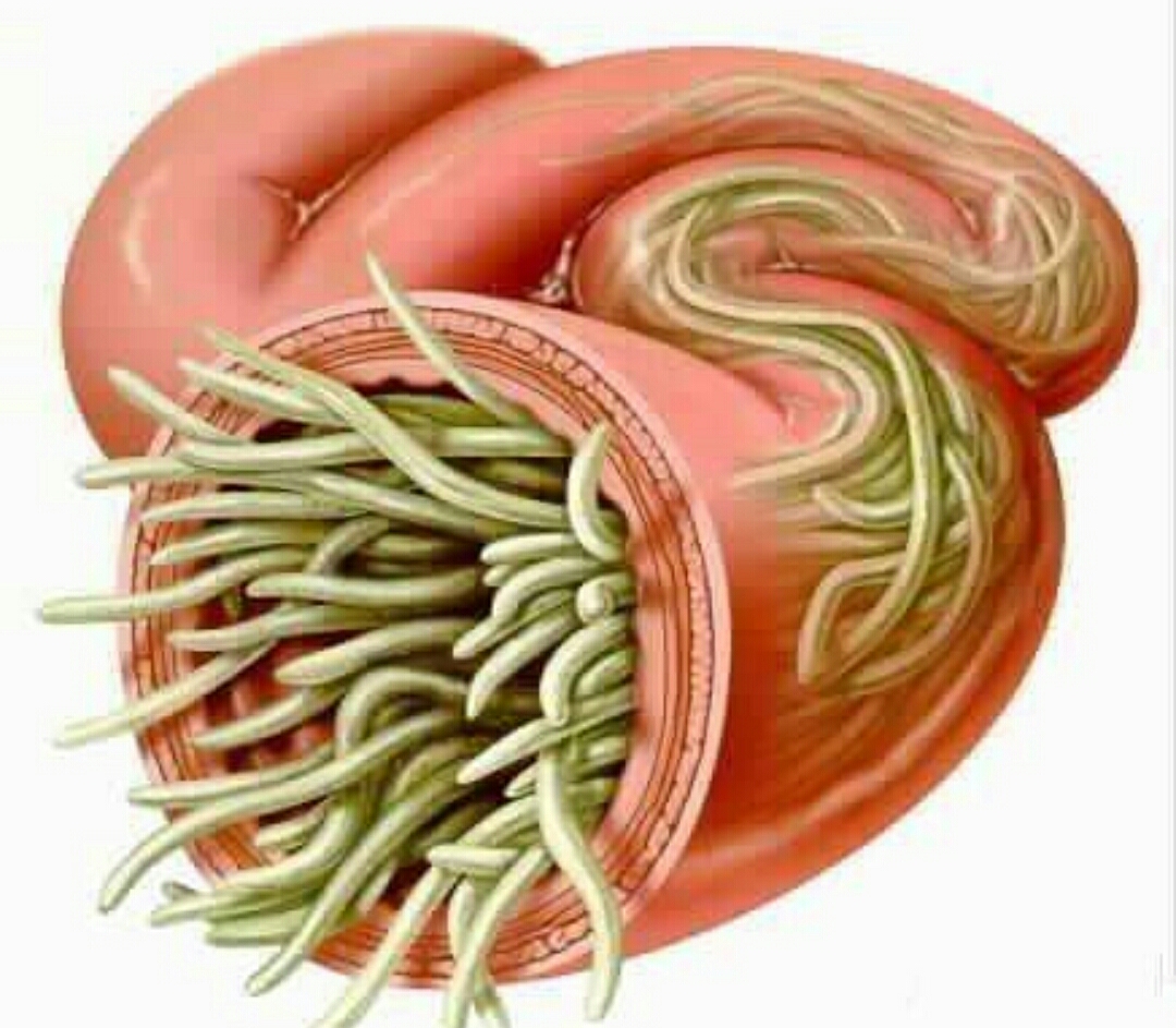 养护肠道健康预防肠炎谨记4件事,小儿应如何预防肠道寄生虫病