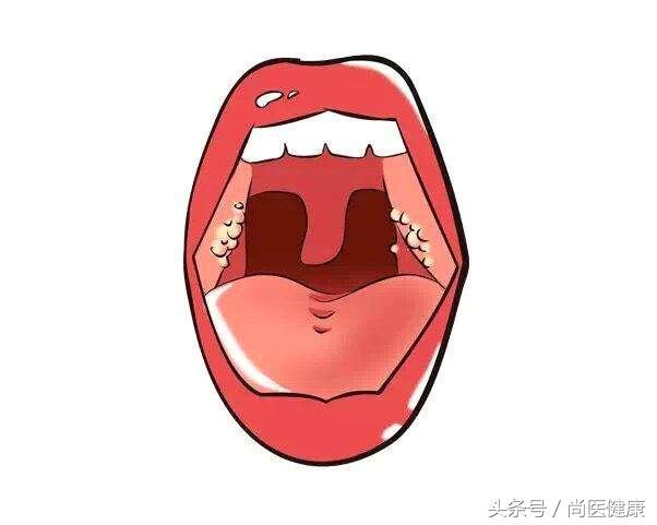宝宝扁桃体总是发炎怎么办,宝宝扁桃体反反复复