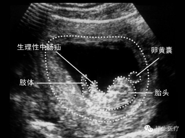 准妈妈看过来孕期瑜伽,孕期b超知识大全