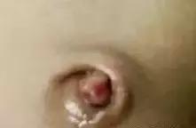 新生儿肚脐5个异常要注意！这篇宝宝脐部护理攻略送给月嫂！