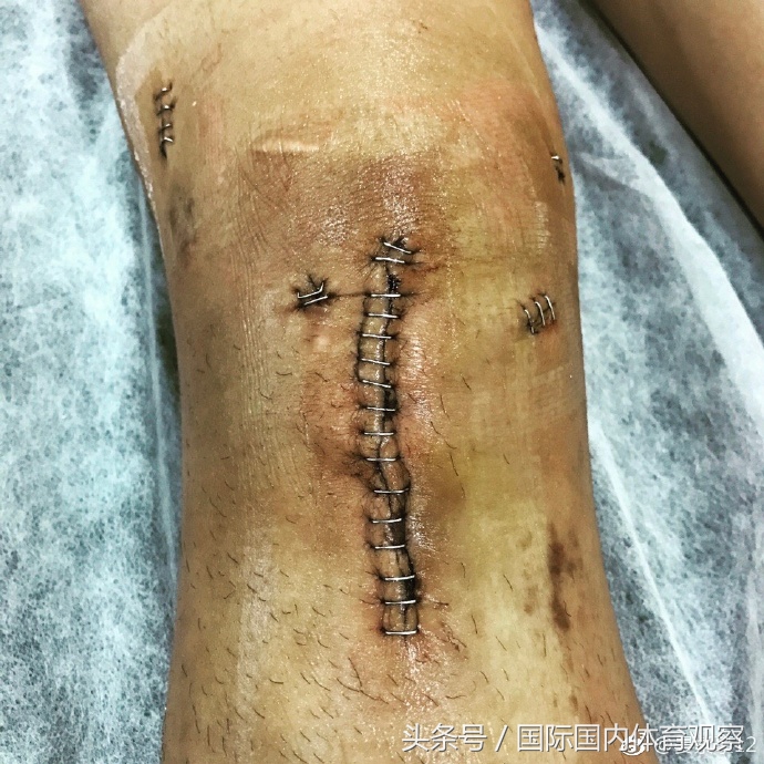 亚冠没报名？热身没上场！权健的这位边路妖星到底怎么了？