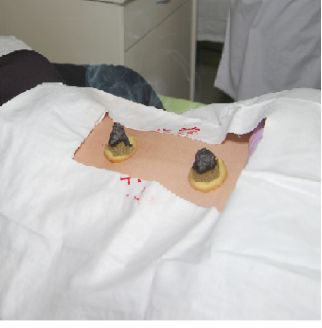 艾灸八髎穴的功效和好处,人体穴位艾灸大全