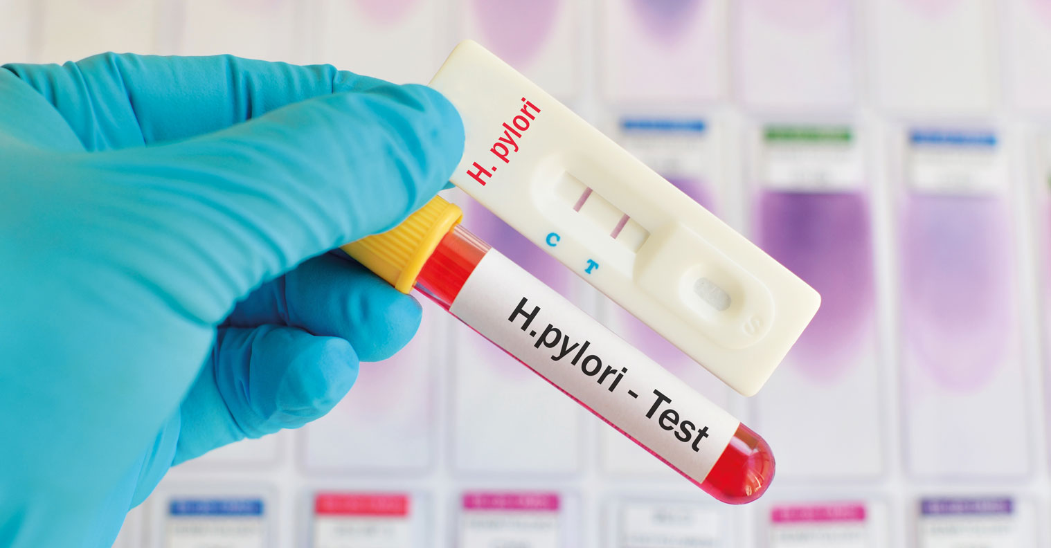 胃不舒服一定要杀幽门螺杆菌吗,胃部幽门螺旋杆菌可以治愈吗