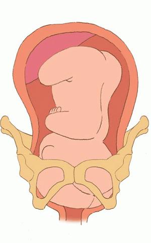 孕妇大肚子在水中分娩过程,中国孕妇在水中分娩过程