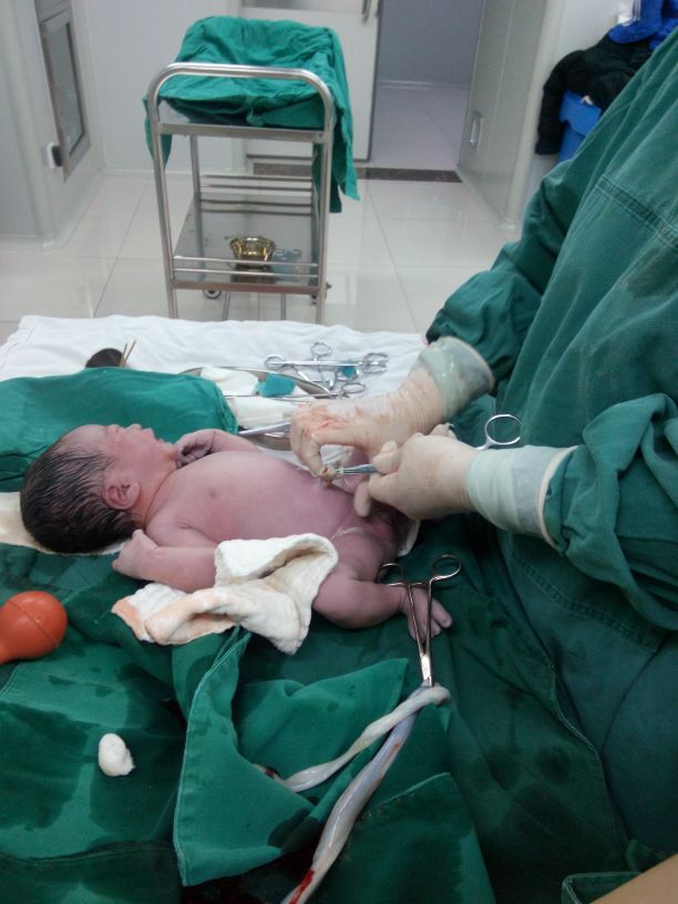 38周左枕横位羊水偏少能顺产,羊水偏少生下来的宝宝正常吗