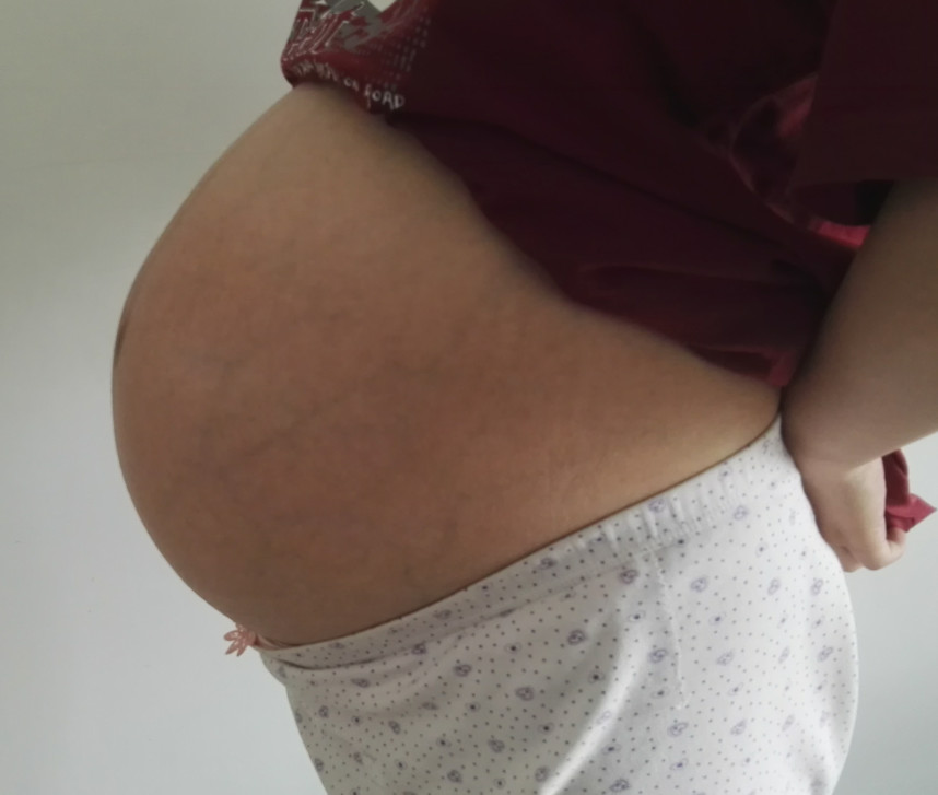 女人怕顺产侧切,为什么有的女的觉得顺产很丢人