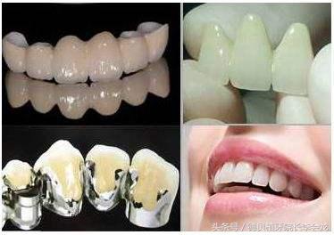 烤瓷牙表面掉瓷了对人身体有害吗,钴铬合金烤瓷牙对身体有害吗