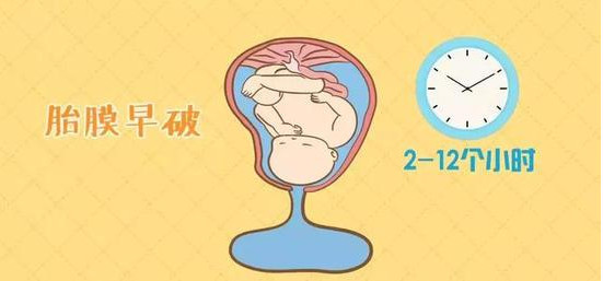 为什么现在生孩子要打催产素,遇到生孩子这个事应该怎么办