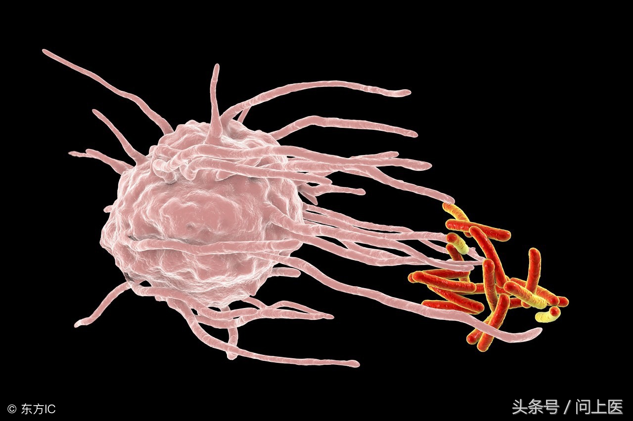 免疫球蛋白检查是查什么,免疫球蛋白检查是什么