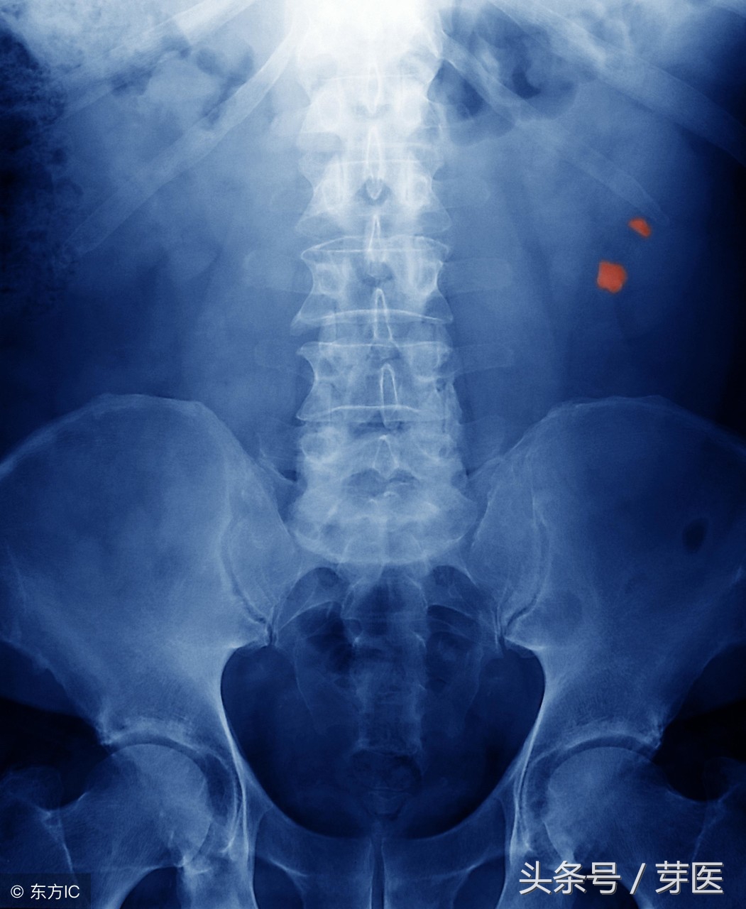 黄帝内经阴阳应象大论感悟,黄帝内经气机不畅