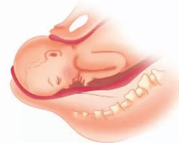 准妈妈必知分娩第二和第三产程