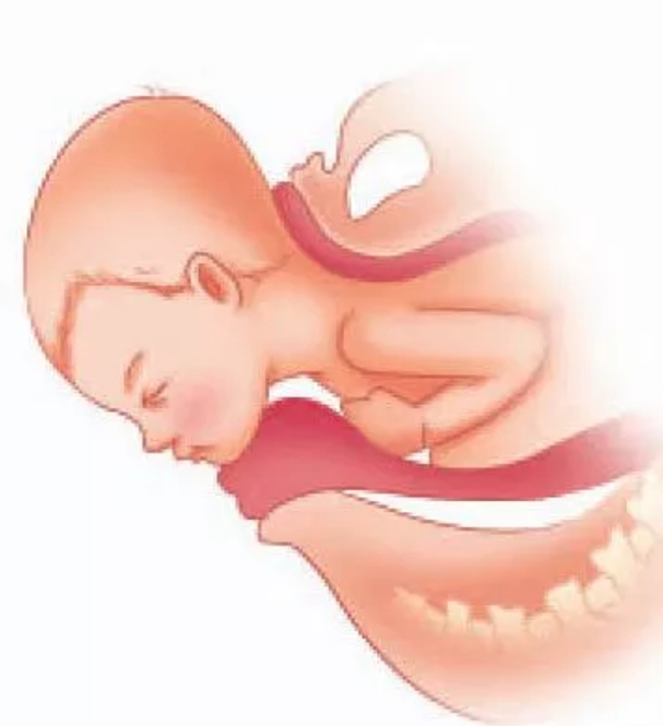 准妈妈必知分娩第二和第三产程