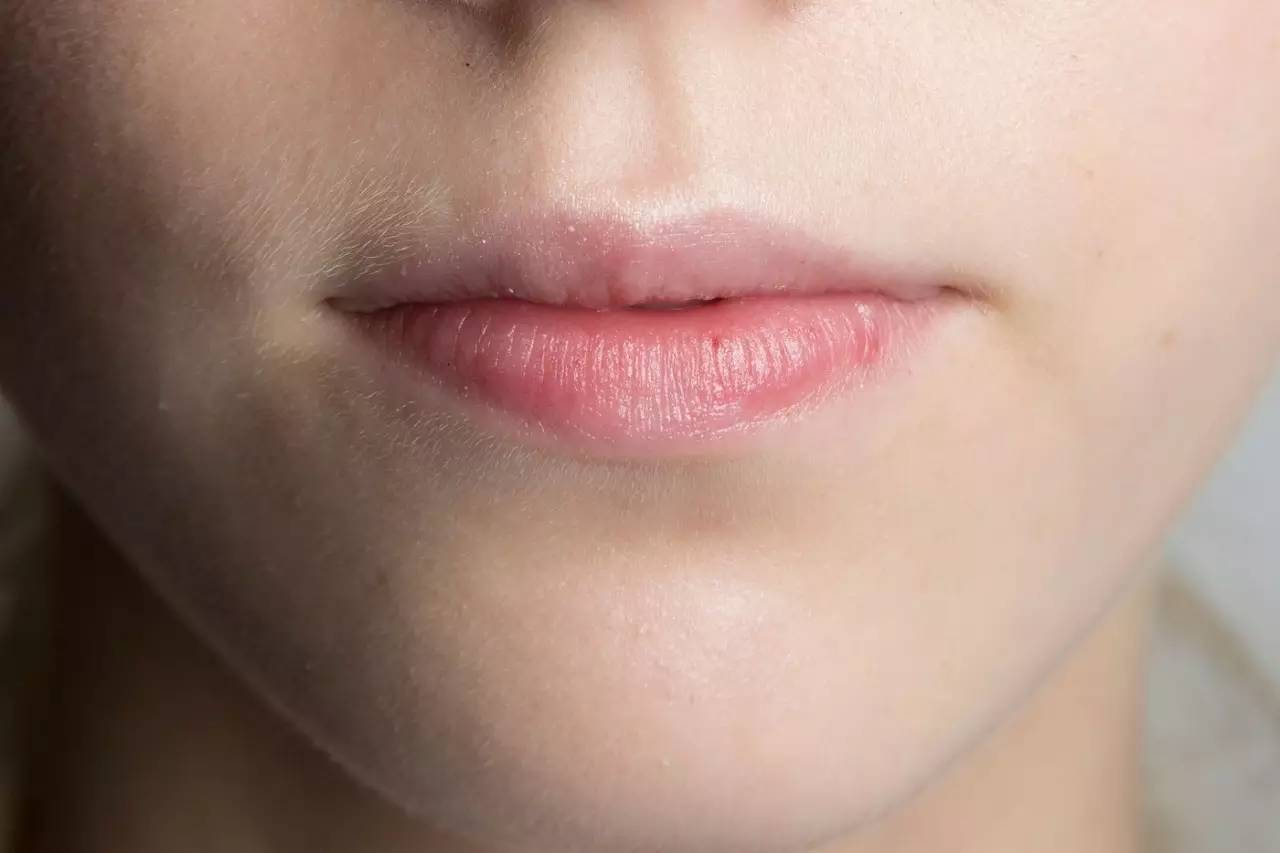 黑头一挤就缩回去,黑头挤了两三次会变大嘛