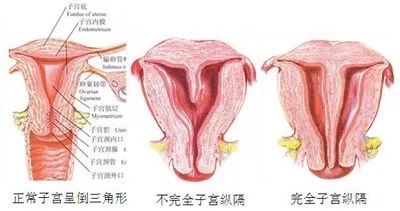 妈妈怀孕时“偷了一下懒”，从此你的子宫多了一坨肉
