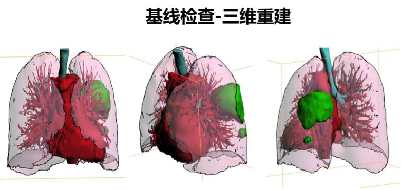 华莹奇医生援鄂了吗,华莹奇
