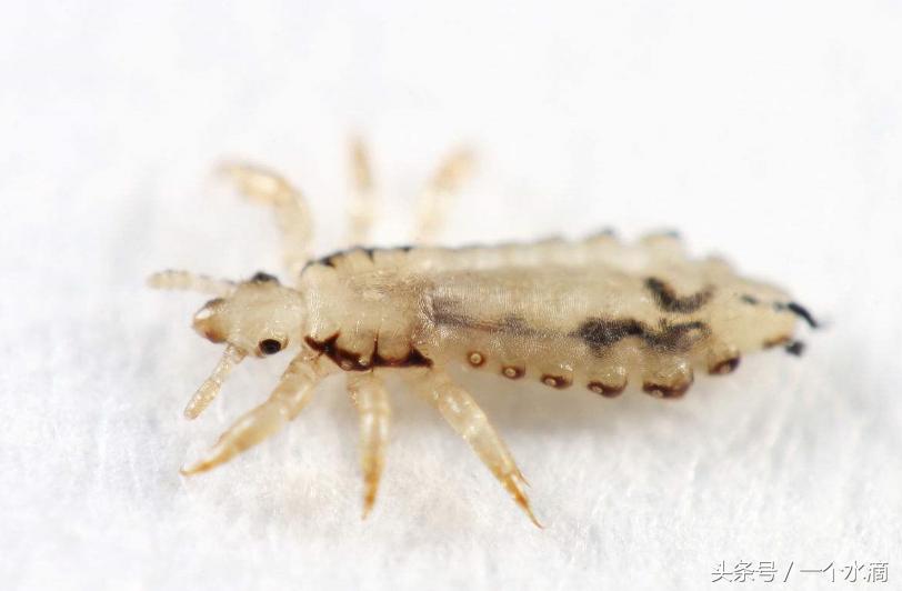 你对虱子和虮子只停留在上世纪六七十年代吗?国外现在还有