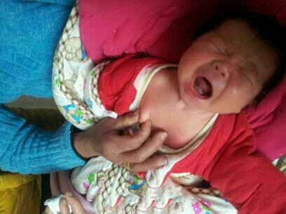 心疼！新生儿挤乳头红肿发炎：到底应不应该给婴儿挤乳头？