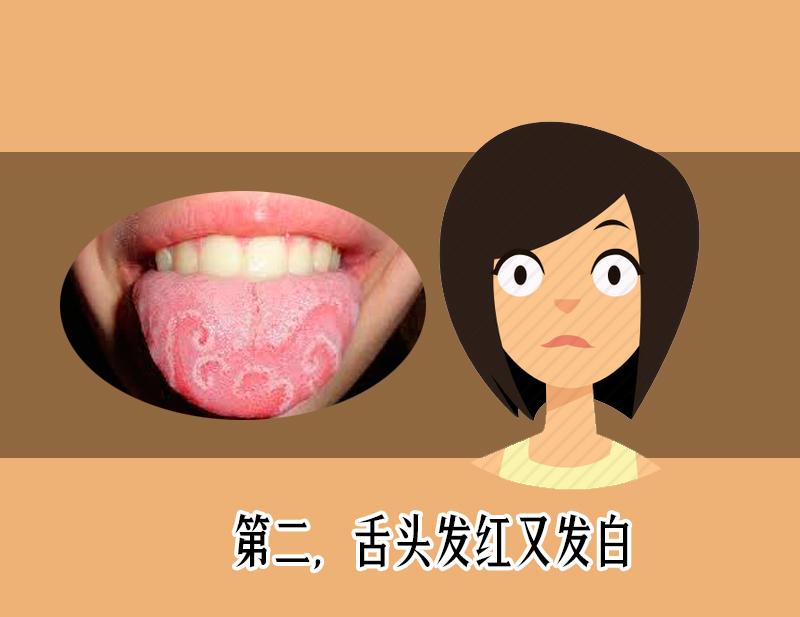 舌头鲜红有舌苔是怎么回事,舌头舌苔很厚变成黑色怎么回事