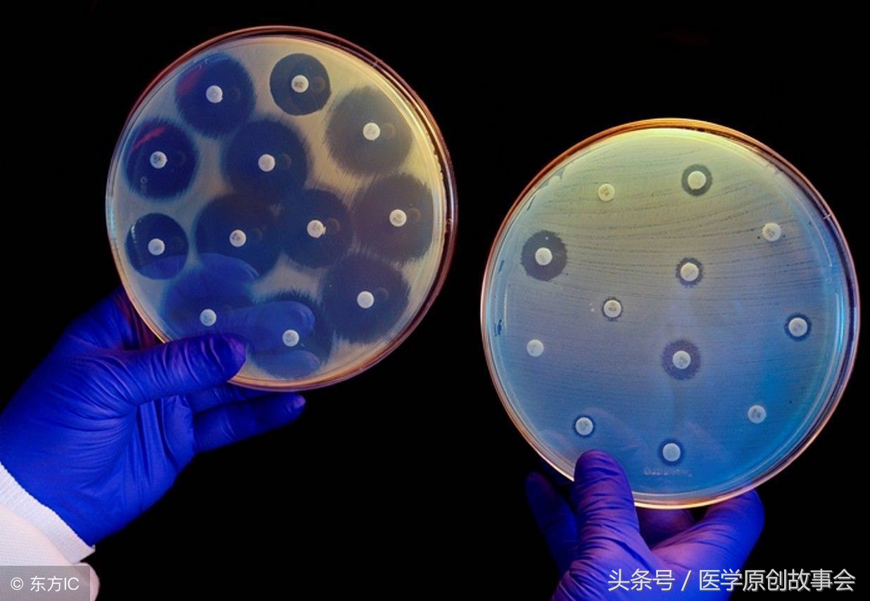 什么药可以杀灭幽门螺杆菌,什么药物可杀灭幽门螺杆菌