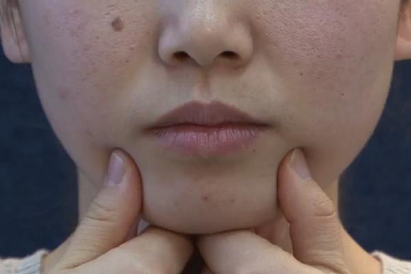 中医教你消除双下巴视频,教你一招告别双下巴