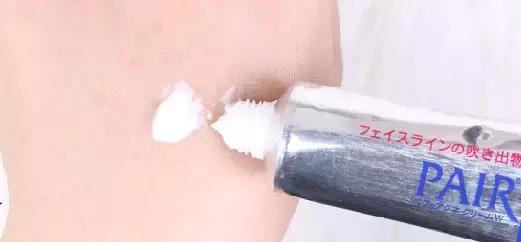 战痘经验,战痘成功的经历