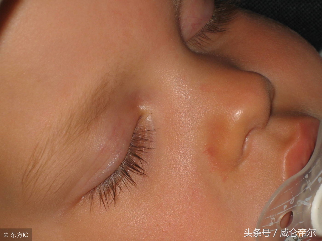 六个月宝宝内火过剩,一个多月的宝宝内火重怎么办