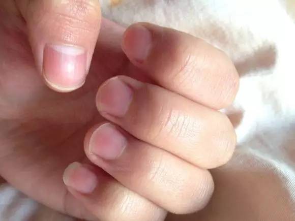 姿势｜家有万金，难买这张表，为了家人请收藏好！