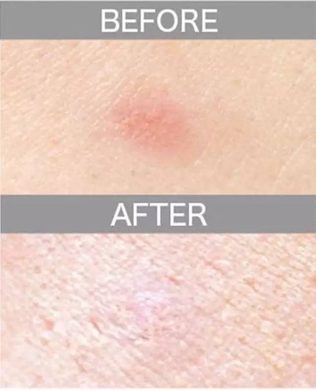 遮瑕膏排行榜10强混合皮肤,比较不错的三色遮瑕膏推荐