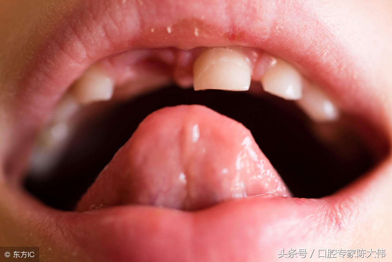 老塞牙，而且还口臭怎么办？