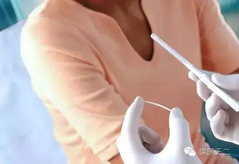 第四代避孕药怎么样,第4代避孕药有哪些