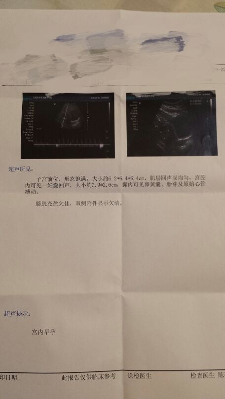 孕酮一直上不去原因,孕酮一直补不上去有胎心胎芽