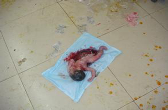 为了能抱孙子，婆婆执意要怀孕5个月的儿媳引产