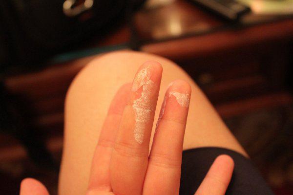 怎么清理粘在身上的口香糖,怎么清理胶水留下的黑污渍