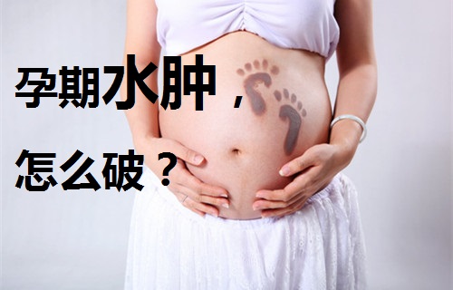 怀孕那些事儿早期,孕期水肿怎么办