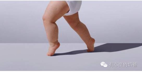 6岁罗圈腿绑腿矫正有用吗,新生儿宝宝需要绑腿防止罗圈腿吗