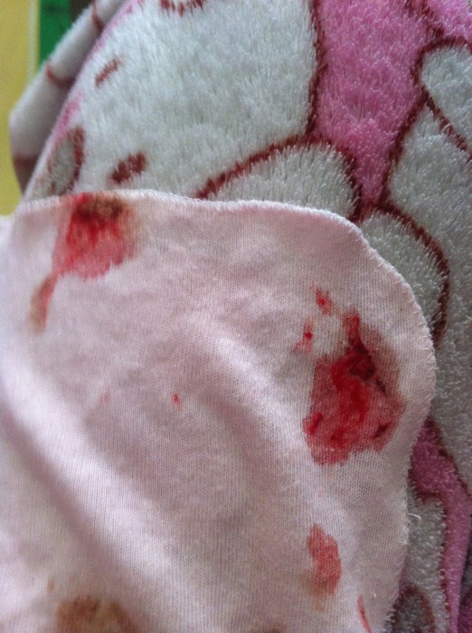 奶奶把饭菜嚼碎了喂宝宝,奶奶嚼碎辅食喂孩子致死