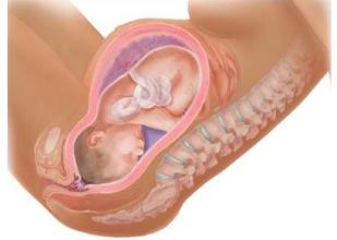 生过孩子女人九成多都会得这个病！