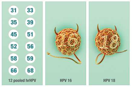 hpv常见问题和解决讲解,hpv常见问题及解决方法