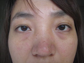 怎么才能跟脸上的斑说拜拜,如何跟黑眼圈和解