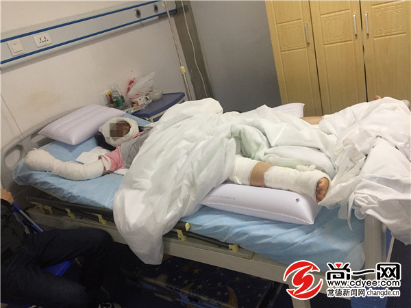 烧伤恢复期疼痛吃止痛药行吗,孕妇烧伤怎么处理